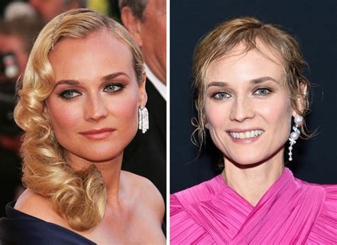 diane kruger breast implants|Diane Kruger Plastic Surgery Before and After Breast。